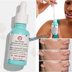 💗FIRST AID BEAUTY Facial Radiance Niacinamide Dark Spot Serum